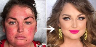 Goar Avetisyan premieňa choré ženy pomocou make-upu na hviezdy